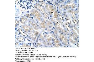 Rabbit Anti-Tsg101 Antibody  Paraffin Embedded Tissue: Mouse Kidney Cellular Data: Epithelial cells of renal tubule Antibody Concentration: 4. (TSG101 抗体  (Middle Region))