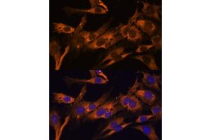 Immunofluorescence analysis of C6 cells using RPL36AL Polyclonal Antibody (ABIN7270007) at dilution of 1:100 (40x lens). (RPL36AL 抗体  (AA 1-106))