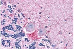 Human Brain, Cerebellum: Formalin-Fixed, Paraffin-Embedded (FFPE) (DNASE1 抗体  (AA 1-252))