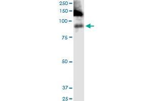 ITGB2 monoclonal antibody (M03), clone 3C7. (Integrin beta 2 抗体  (AA 1-769))