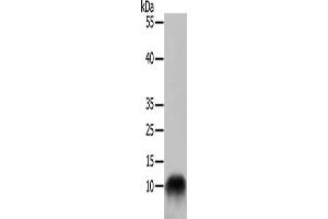 Gel: 10+15 % SDS-PAGE, Lysate: 50 μg, Lane: 293T cells, Primary antibody: ABIN7129018(COX7B Antibody) at dilution 1/700, Secondary antibody: Goat anti rabbit IgG at 1/8000 dilution, Exposure time: 30 seconds (COX7B 抗体)