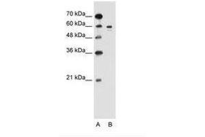 Image no. 1 for anti-Tyrosinase (TYR) (AA 321-370) antibody (ABIN205038) (TYR 抗体  (AA 321-370))