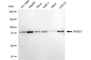 Western blotting analysis using RASEF antibody (ABIN7800137).