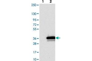 Western blot analysis of Lane 1: Negative control (vector only transfected HEK293T lysate). (BPGM 抗体)