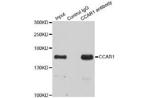 Immunoprecipitation analysis of 200ug extracts of HeLa cells using 3ug CCAR1 antibody. (CCAR1 抗体  (AA 1-200))