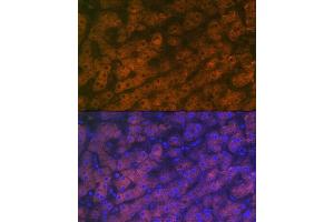 Immunofluorescence analysis of human liver using RBP4 Rabbit mAb (ABIN7269951) at dilution of 1:100 (40x lens).