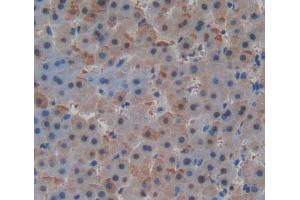 Used in DAB staining on fromalin fixed paraffin- embedded Kidney tissue (MLYCD 抗体  (AA 191-493))
