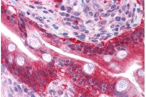 Immunohistochemistry (Formalin-fixed Paraffin-embedded Sections) (IHC (fp)) image for anti-Galectin 3 (LGALS3) (AA 38-87) antibody (ABIN6745755)