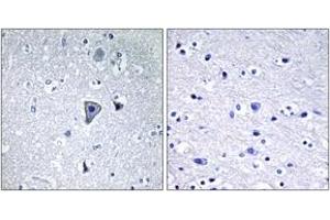 Immunohistochemistry analysis of paraffin-embedded human brain tissue, using GRM1 Antibody. (Metabotropic Glutamate Receptor 1 抗体  (AA 251-300))