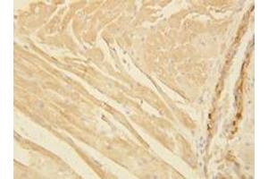 Immunohistochemistry (Paraffin-embedded Sections) (IHC (p)) image for anti-Actin (AA 367-377), (C-Term), (pan) antibody (ABIN1105235)