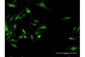 Immunofluorescence of purified MaxPab antibody to CACNB3 on HeLa cell. (CACNB3 抗体  (AA 1-484))