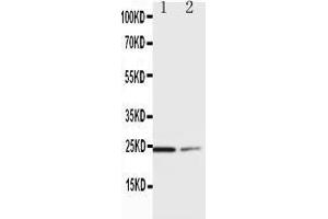 Anti-SOCS1 antibody, Western blotting Lane 1:  Cell Lysate Lane 2: COLO320 Cell Lysate (SOCS1 抗体  (C-Term))