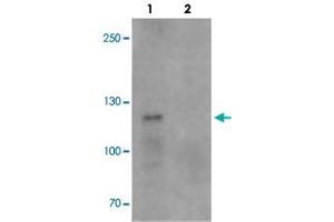 Western blot analysis of TCIRG1 in EL4 cell lysate with TCIRG1 polyclonal antibody  at 0. (TCIRG1 抗体  (N-Term))