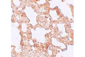 Immunohistochemical staining of rat lung cells with AXIN2 polyclonal antibody  at 5 ug/mL. (AXIN2 抗体  (C-Term))