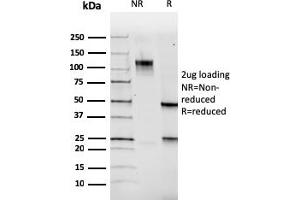 Western Blotting (WB) image for anti-Paired Box 5 (PAX5) (AA 235-382) antibody (ABIN6940256)