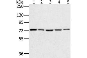 Gel: 6 % SDS-PAGE, Lysate: 40 μg, Lane 1-5: Hela, lncap, skov3, 293T and TM4 cell, Primary antibody: ABIN7131341(TGM4 Antibody) at dilution 1/400 dilution, Secondary antibody: Goat anti rabbit IgG at 1/8000 dilution, Exposure time: 10 seconds (TGM4 抗体)