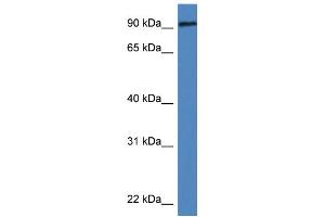 WB Suggested Anti-Dlg3 Antibody   Titration: 1. (DLG3 抗体  (N-Term))
