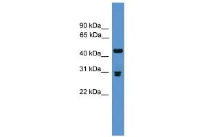 WB Suggested Anti-Pdyn Antibody Titration: 0. (PDYN 抗体  (Middle Region))
