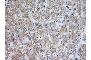 Immunohistochemical staining of paraffin-embedded Human pancreas tissue using anti-RAB17 mouse monoclonal antibody. (RAB17 抗体)