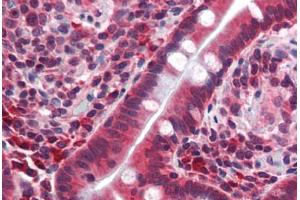 Human Small Intestine (formalin-fixed, paraffin-embedded) stained with TFCP2L1 antibody ABIN462172 followed by biotinylated goat anti-rabbit IgG secondary antibody ABIN481713, alkaline phosphatase-streptavidin and chromogen. (TFCP2L1 抗体  (AA 20-69))