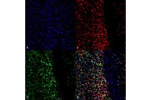 Immunocytochemistry/Immunofluorescence analysis using Rabbit Anti-Alpha Synuclein pSer129 Polyclonal Antibody (ABIN5650939). (SNCA 抗体  (pSer129) (Atto 488))