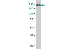 Western Blotting (WB) image for anti-ATP-Binding Cassette, Sub-Family C (CFTR/MRP), Member 4 (ABCC4) (AA 1-110) antibody (ABIN564442)