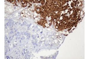 Image no. 2 for anti-Parvin, beta (PARVB) antibody (ABIN1496912) (Parvin, beta 抗体)