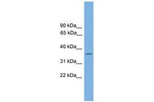 Image no. 1 for anti-DnaJ (Hsp40) Homolog, Subfamily C, Member 17 (DNAJC17) (AA 151-200) antibody (ABIN6744622) (DNAJC17 抗体  (AA 151-200))