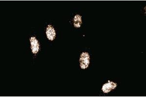 Immunofluorescence staining of human endothelial cells. (Cullin 3 抗体  (AA 565-684))