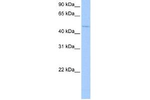 WB Suggested Anti-RBM45 Antibody  Titration: 0. (RBM45 抗体  (Middle Region))