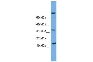 PLA2G2E antibody used at 2. (PLA2G2E 抗体  (Middle Region))