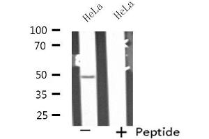 Western blot analysis of extracts from HeLa cells, using PPP2R2B antibody. (PPP2R2B 抗体  (Internal Region))