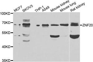 Western blot analysis of extracts of various cell lines, using ZNF20 antibody. (ZNF20 抗体)