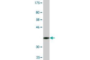 Western Blot detection against Immunogen (35. (NEUROD6 抗体  (AA 246-337))