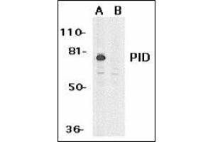 Western blot analysis of PID expression in HeLa whole cell lysates in the absence (A) or presence (B) of blocking peptide with this product at 1 μg /ml. (MTA2 抗体  (AA 652-668))