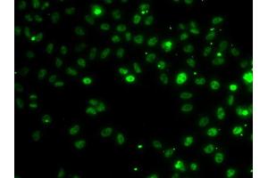 Immunofluorescence analysis of MCF-7 cells using RSRC1 antibody (ABIN6131423, ABIN6147283, ABIN6147284 and ABIN6223040). (RSRC1 抗体  (AA 117-276))