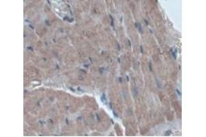 IHC-P analysis of Rat Heart Tissue, with DAB staining. (ORM1 抗体  (AA 20-186))