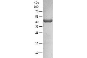 Western Blotting (WB) image for Mevalonate (Diphospho) Decarboxylase (MVD) (AA 1-400) protein (His tag) (ABIN7286458) (MVD Protein (AA 1-400) (His tag))