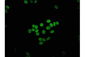 Immunofluorescence staining of HepG2 cells with ABIN7152078 at 1:133, counter-stained with DAPI. (ETV2 抗体  (AA 74-201))