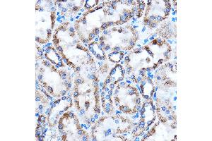 Immunohistochemistry (IHC) image for anti-Connective Tissue Growth Factor (CTGF) (AA 27-349) antibody (ABIN6139188)