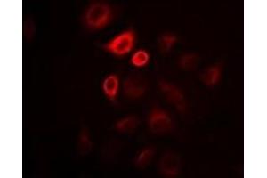 Immunofluorescent analysis of Omentin staining in Hela cells. (ITLN1/Omentin 抗体)