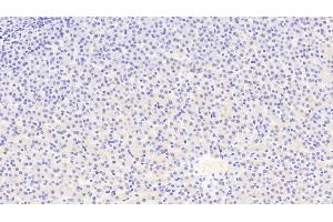 Detection of ATG16L1 in Human Liver Tissue using Polyclonal Antibody to Autophagy Related Protein 16 Like Protein 1 (ATG16L1) (ATG16L1 抗体  (AA 342-607))