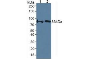 Western Blotting (WB) image for Cartilage Oligomeric Matrix Protein (COMP) ELISA Kit (ABIN6720567)