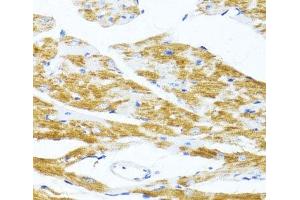 Immunohistochemistry of paraffin-embedded Mouse heart using MS4A8B Polyclonal Antibody at dilution of 1:100 (40x lens). (Membrane-Spanning 4-Domains, Subfamily A, Member 8 (MS4A8) 抗体)