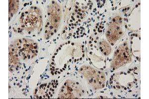 Immunohistochemistry (IHC) image for anti-Nonhomologous End-Joining Factor 1 (NHEJ1) antibody (ABIN1499729) (NHEJ1 抗体)