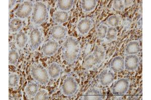 Immunoperoxidase of monoclonal antibody to SHC1 on formalin-fixed paraffin-embedded human stomach.