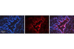 Immunohistochemistry (IHC) image for anti-Inhibitor of DNA Binding 1, Dominant Negative Helix-Loop-Helix Protein (ID1) (Middle Region) antibody (ABIN5516062)