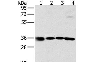 Western Blot analysis of 293T, K562, 231 and hela cell using MRPL39 Polyclonal Antibody at dilution of 1:600 (MRPL39 抗体)