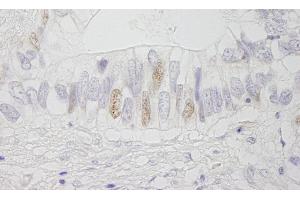 Immunohistochemistry (IHC) image for anti-Adenomatous Polyposis Coli (APC) (AA 1-50) antibody (ABIN7448412) (APC 抗体  (AA 1-50))