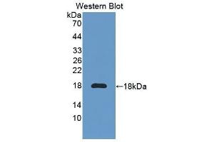 Western Blotting (WB) image for anti-Interleukin 6 Receptor (IL6R) (AA 52-204) antibody (ABIN3206019) (IL-6 Receptor 抗体  (AA 52-204))